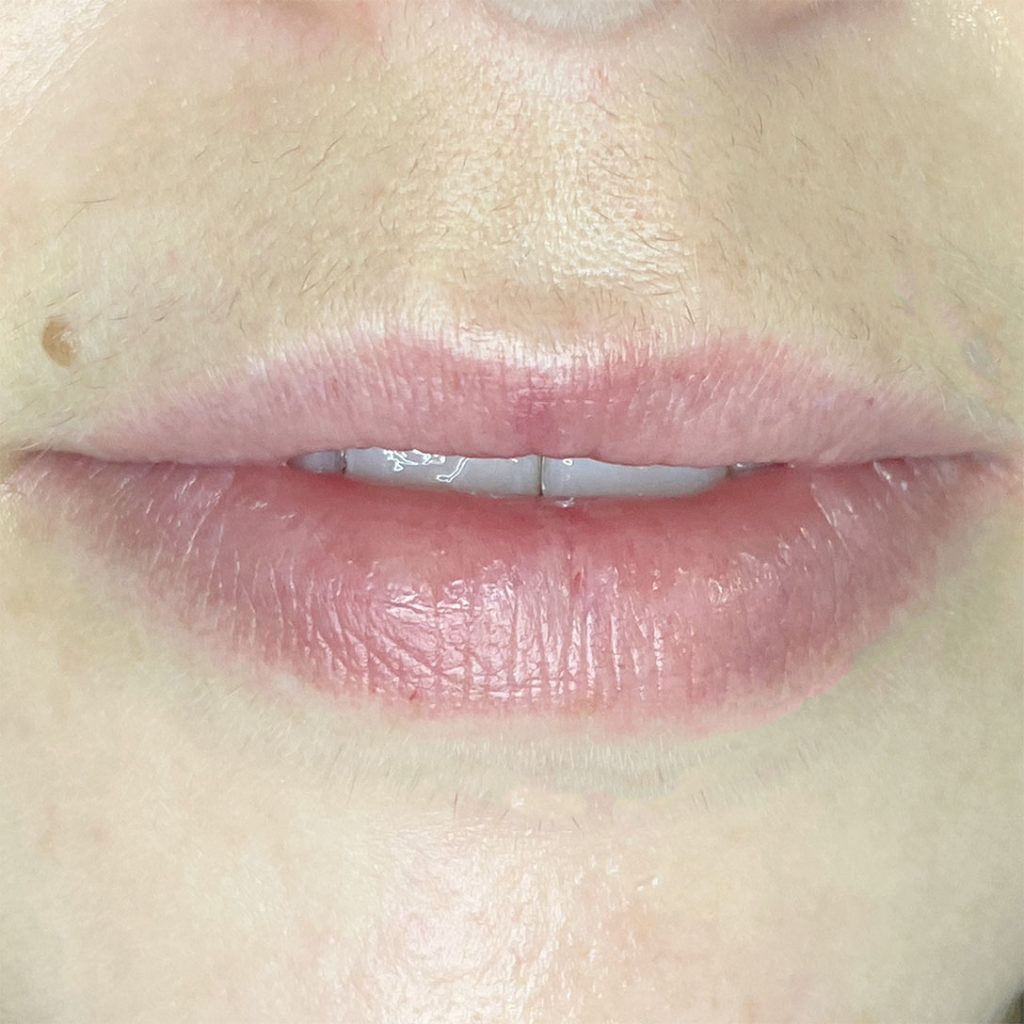 mejorar-el-color-de-los-labios