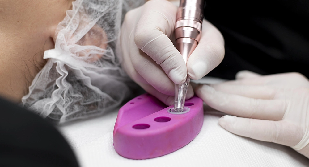 tratamiento de microblading o micropigmentación