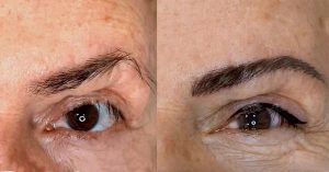 micropigmentación oncológica y micropigmentación paramédica