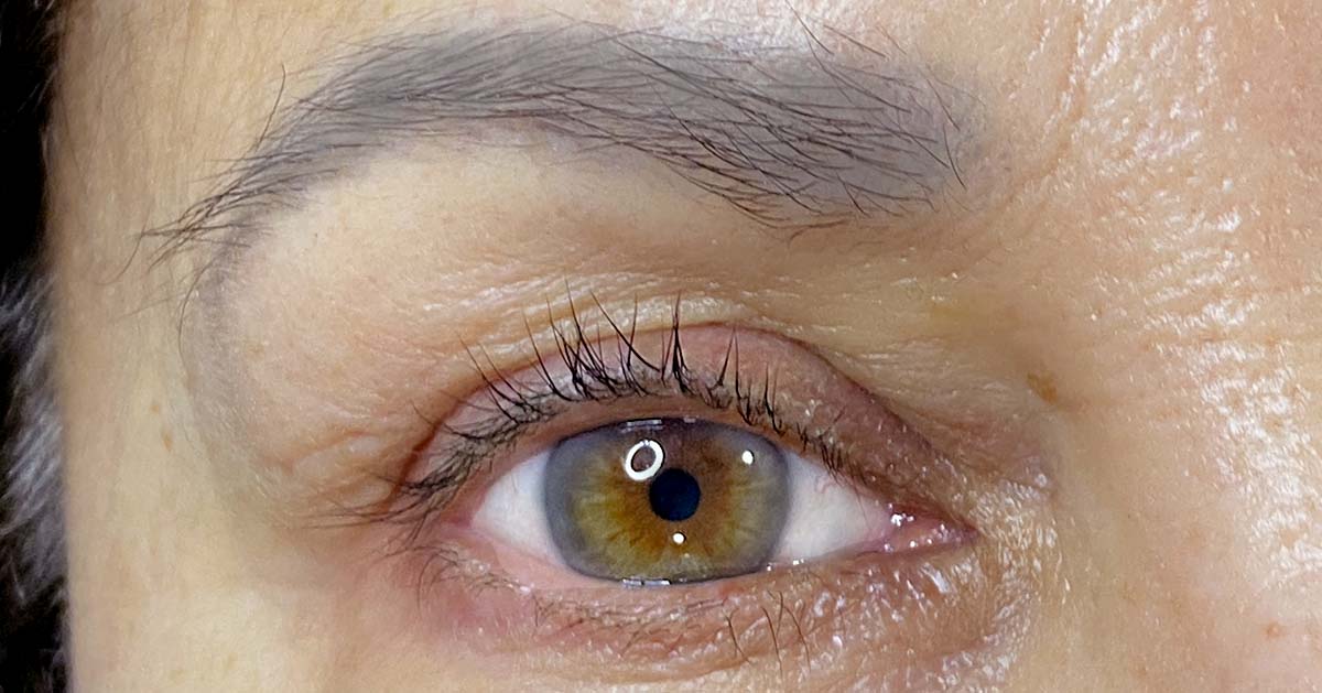 microblading-neutralizacion-before