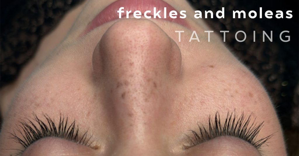 micropigmentation of freckles and moles
