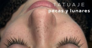 micropigmentacion de pecas y lunares